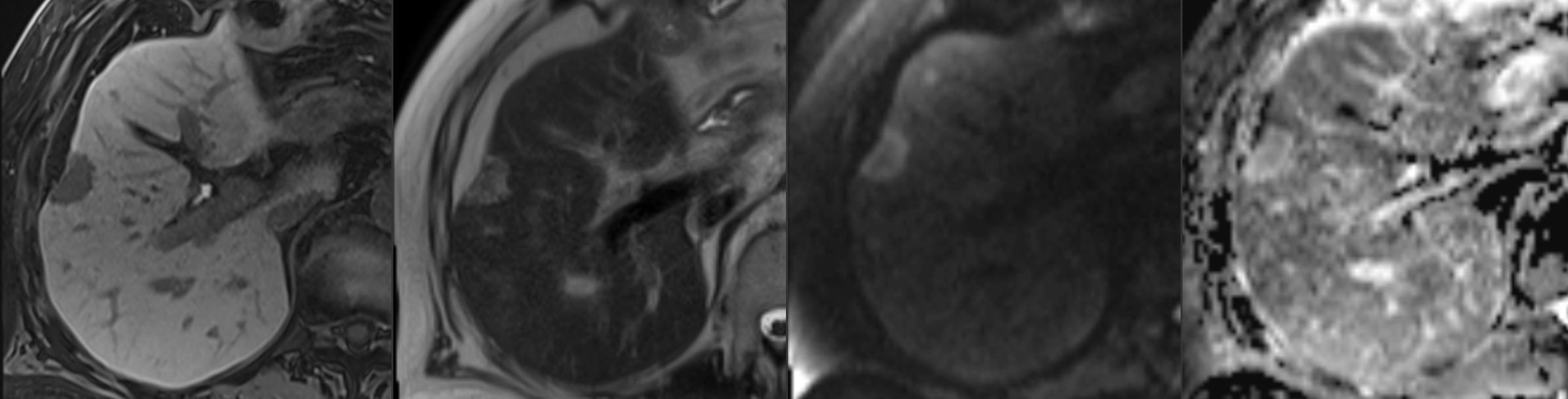 Abbreviated MRI banner