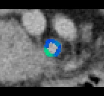 Image analysis and tools