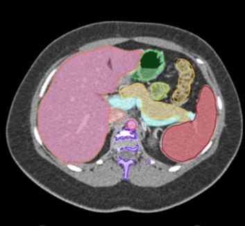 AI-enabled DICOM viewer