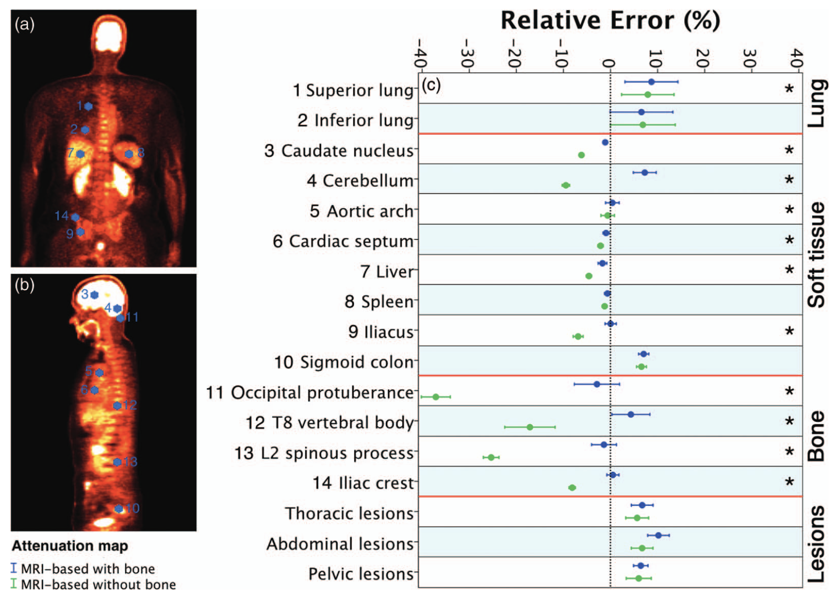 Figure 1: Region of interest analysis for MR-based AC with and without bones
