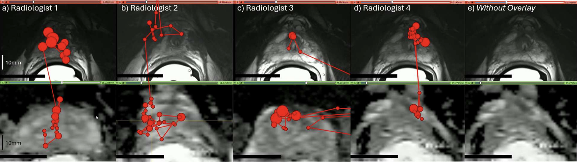 Prostate MRI showing the visual search patterns of four radiologists alongside images without eye-tracking overlays
