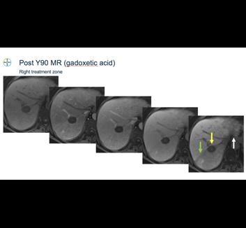 4-cases lecture