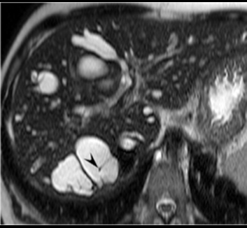 Cystic lesion lecture