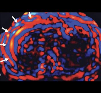 Elastography lecture